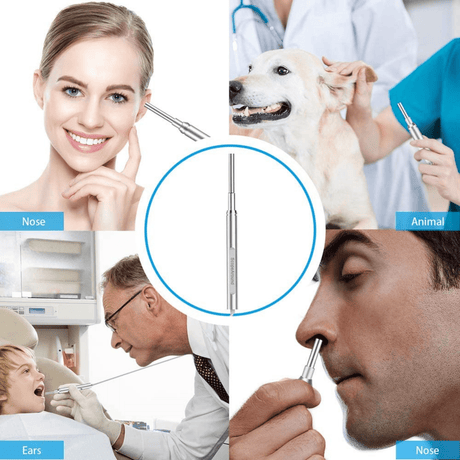 ScopeAround Endoscopio Inalambrico con Conexion a Dispositivo Movil - Haz Tu Pedido