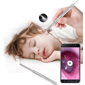 ScopeAround Endoscopio Inalambrico con Conexion a Dispositivo Movil - Haz Tu Pedido
