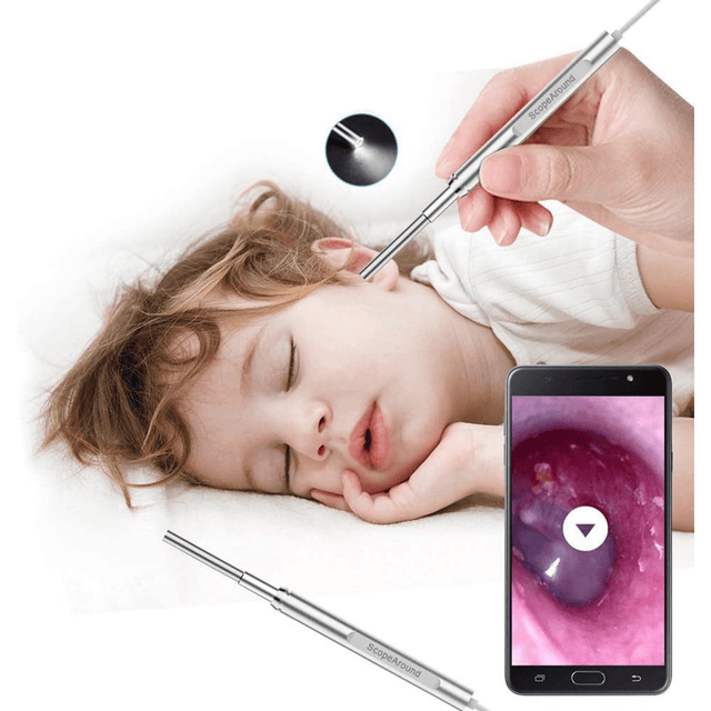 ScopeAround Endoscopio Inalambrico con Conexion a Dispositivo Movil - Haz Tu Pedido