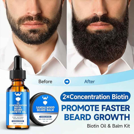 MistySprite Kit de Aceite y Bálsamo para Crecimiento de Barba