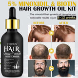 Sefudun Biotina con Minoxidil Crecimiento del Cabello - 60 ml