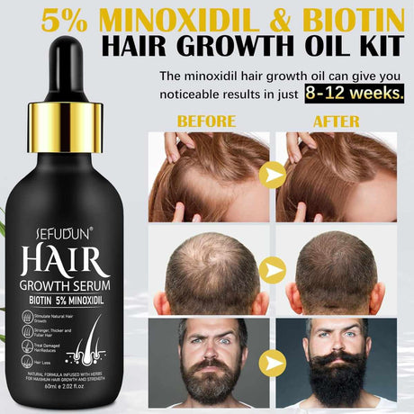 Sefudun Biotina con Minoxidil Crecimiento del Cabello - 60 ml
