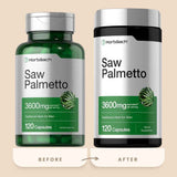 Horbaach Saw Palmetto 3600 mg equivalente, comparación de presentación anterior y actual de 120 cápsulas